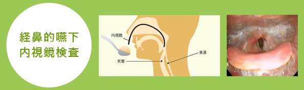 経鼻的嚥下内視鏡検査